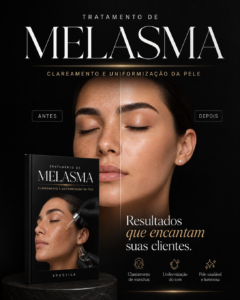 arte_7_melasma
